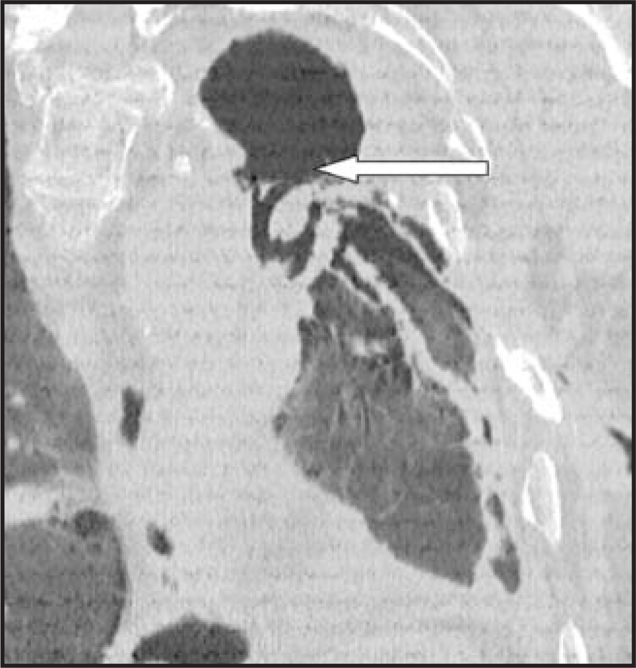 FIGURE 23.