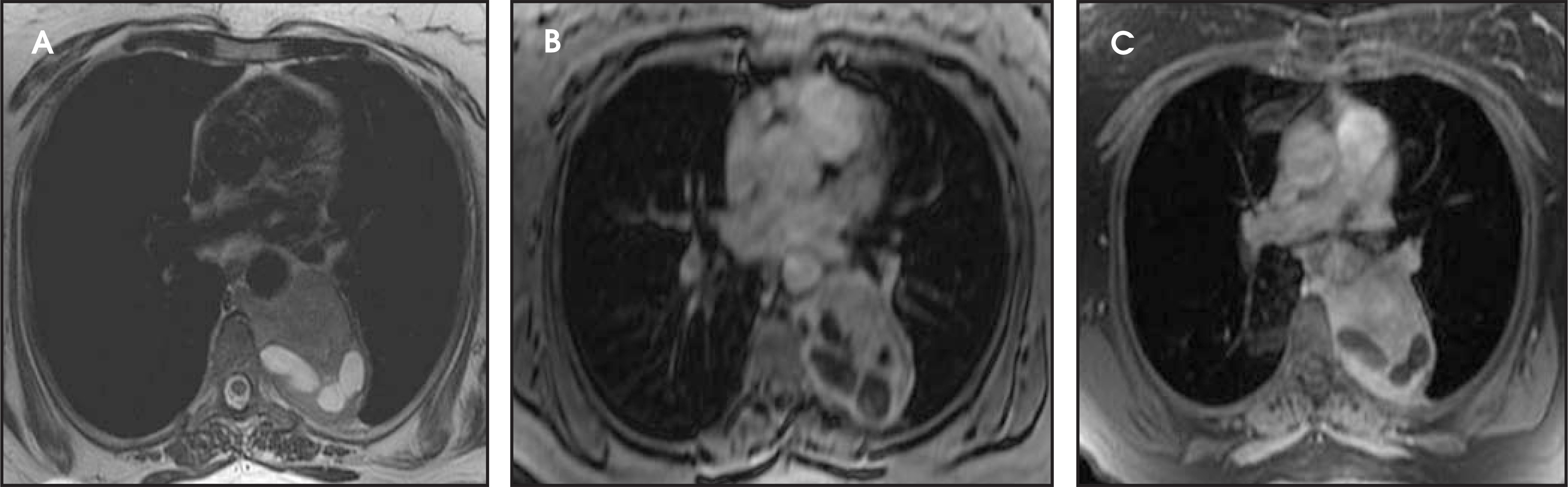 FIGURE 11.