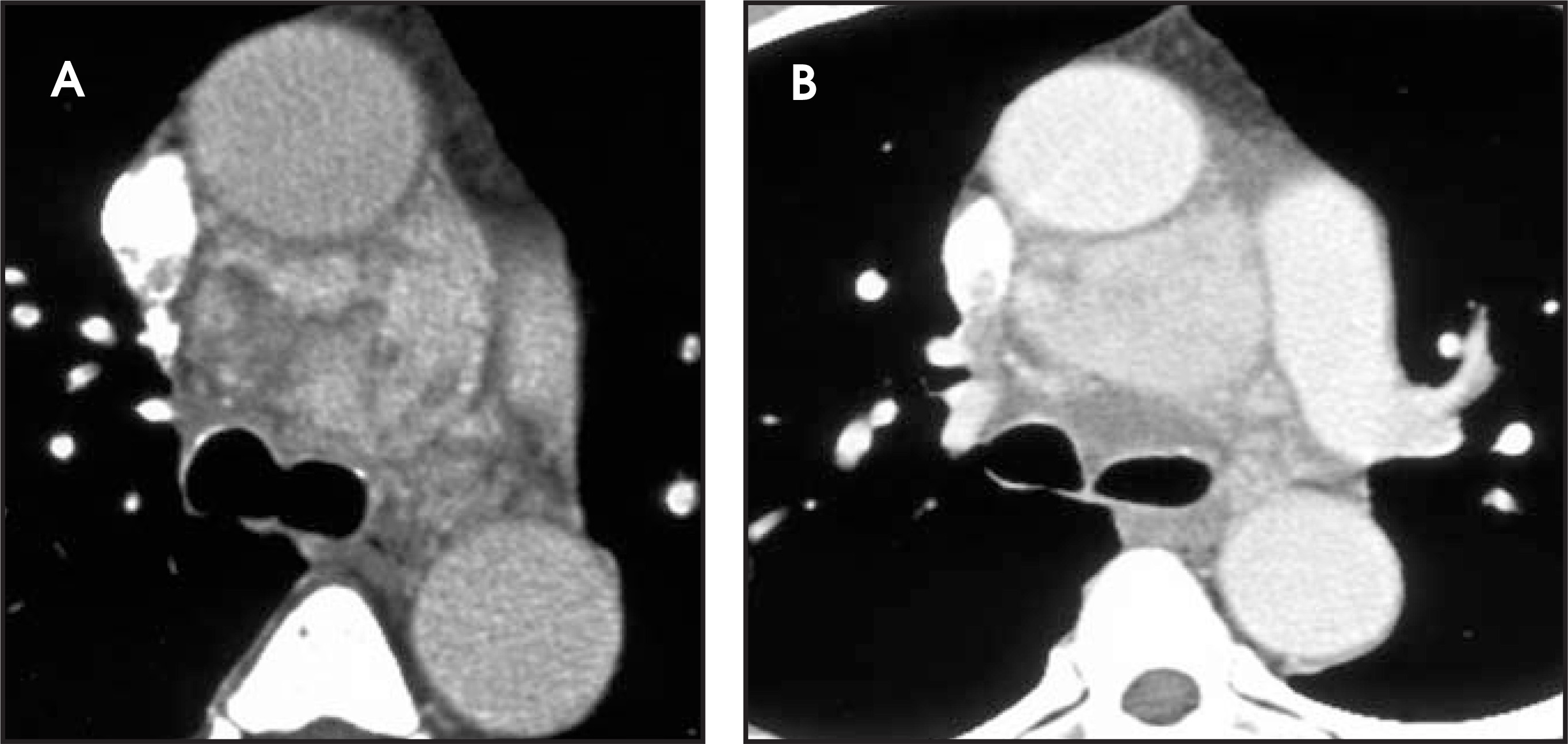 FIGURE 13.