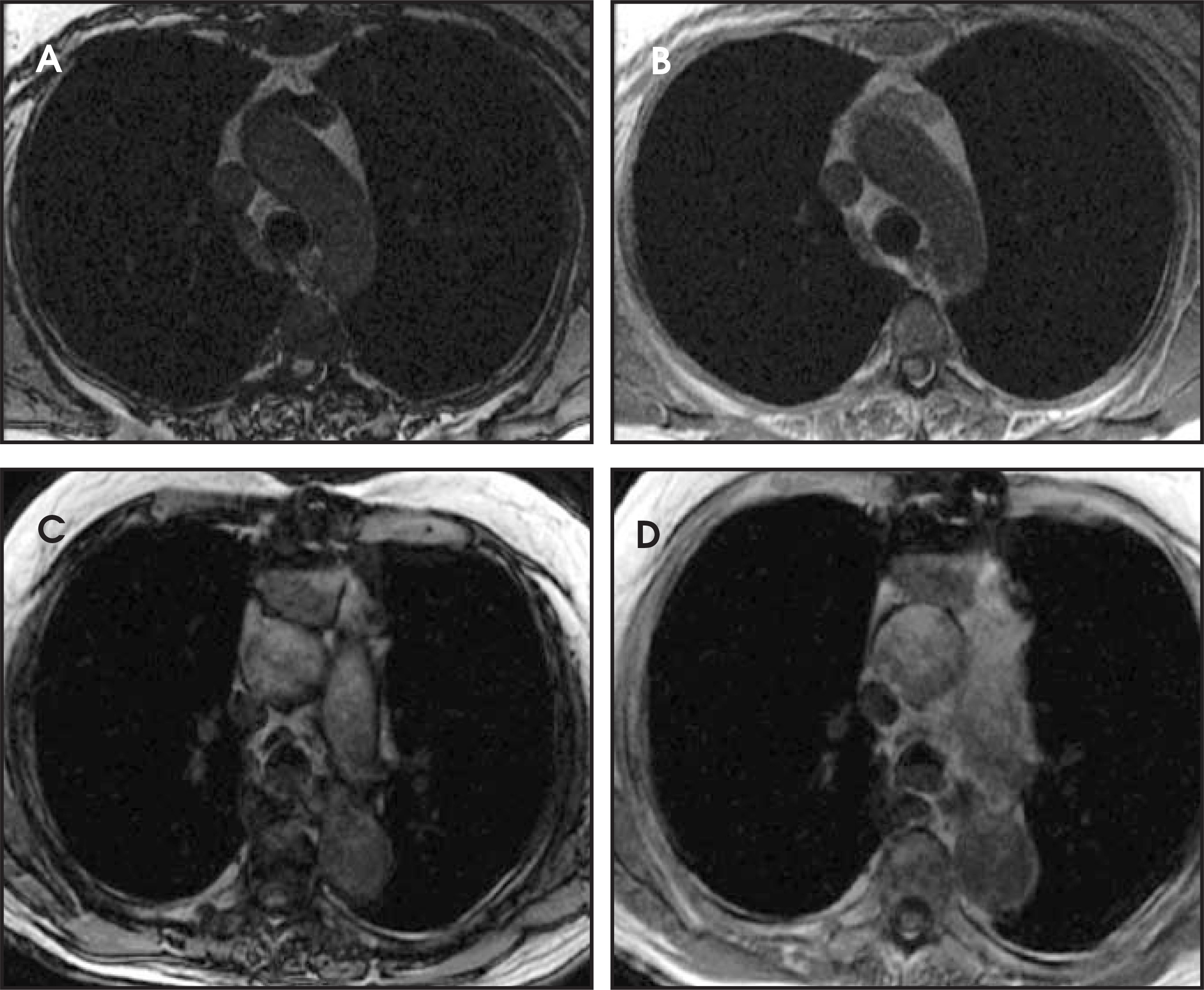FIGURE 14.