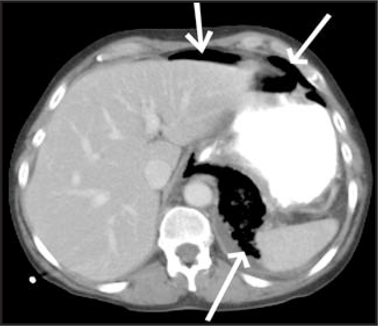 FIGURE 4.