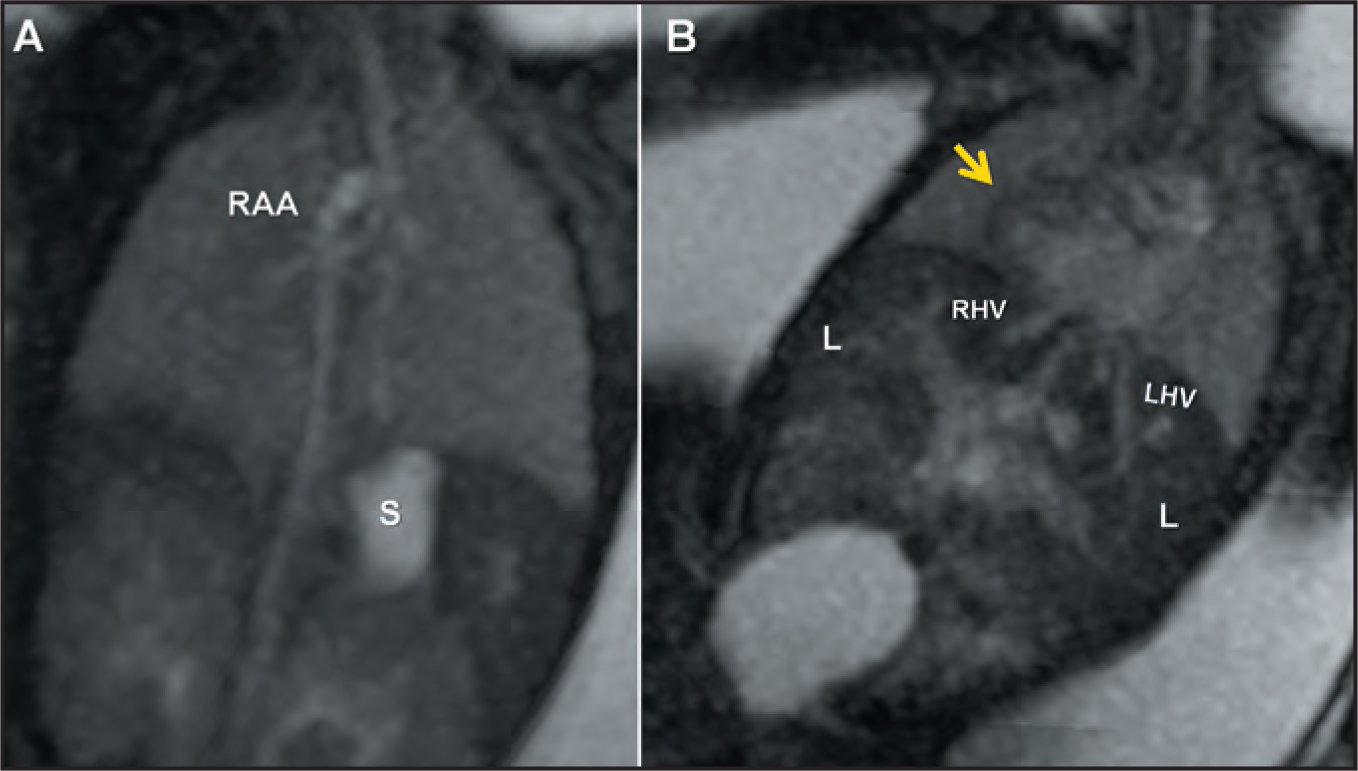 FIGURE 11.