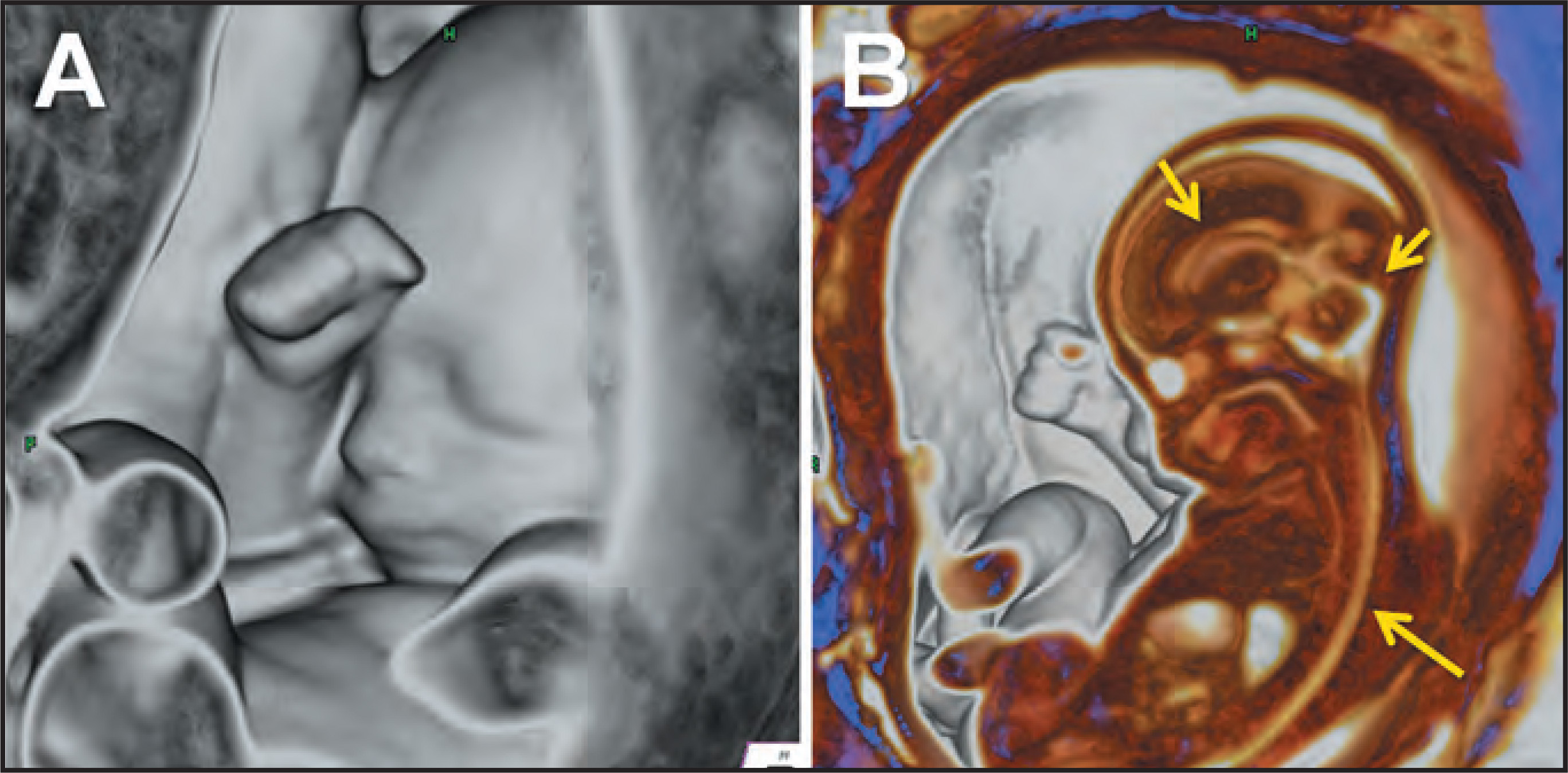 FIGURE 13.