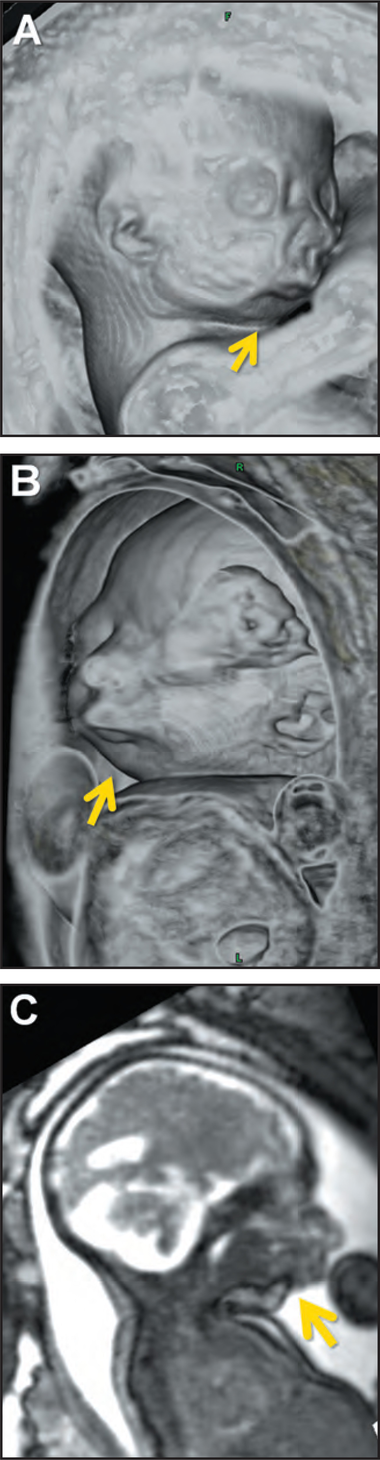 FIGURE 14.