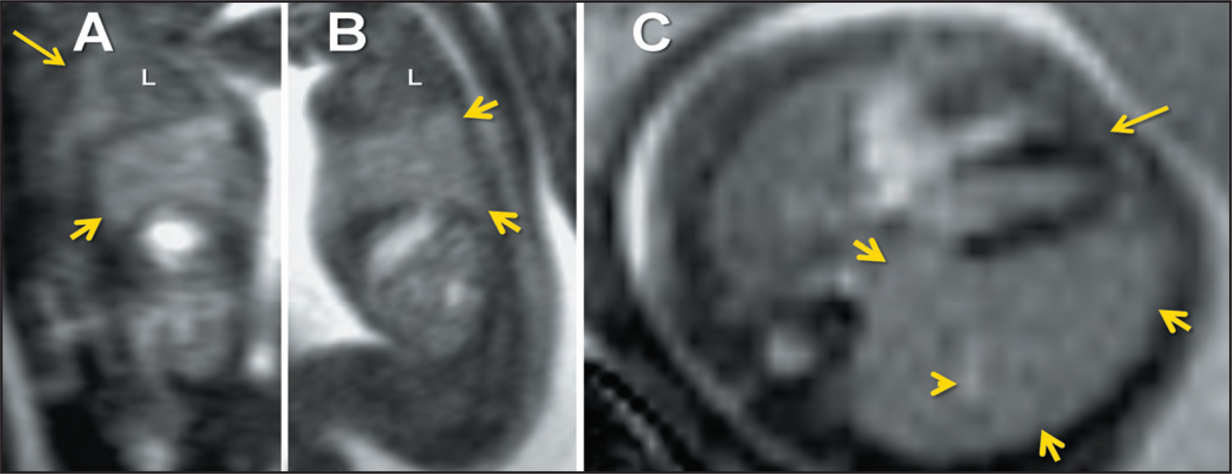 FIGURE 16.