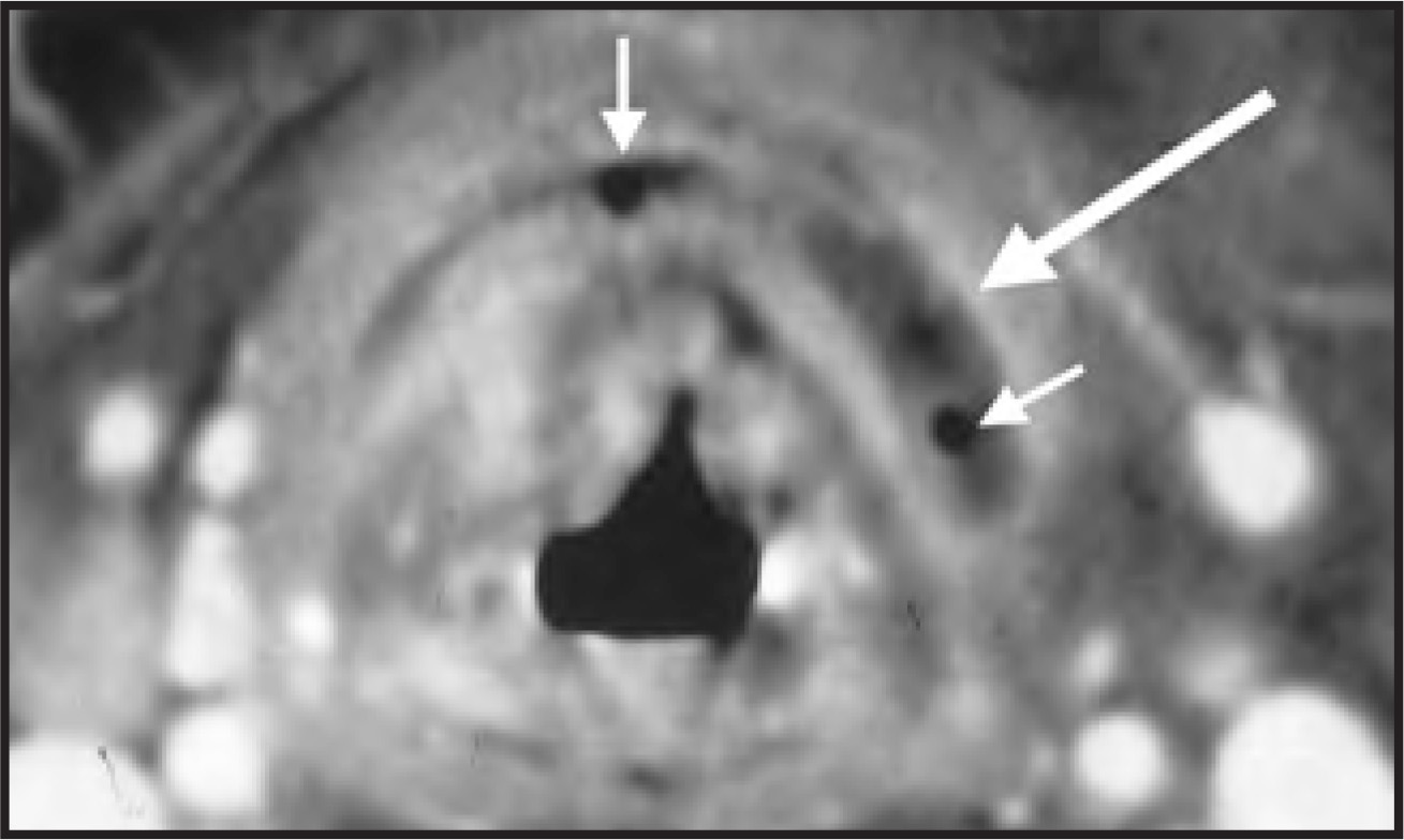 FIGURE 11.