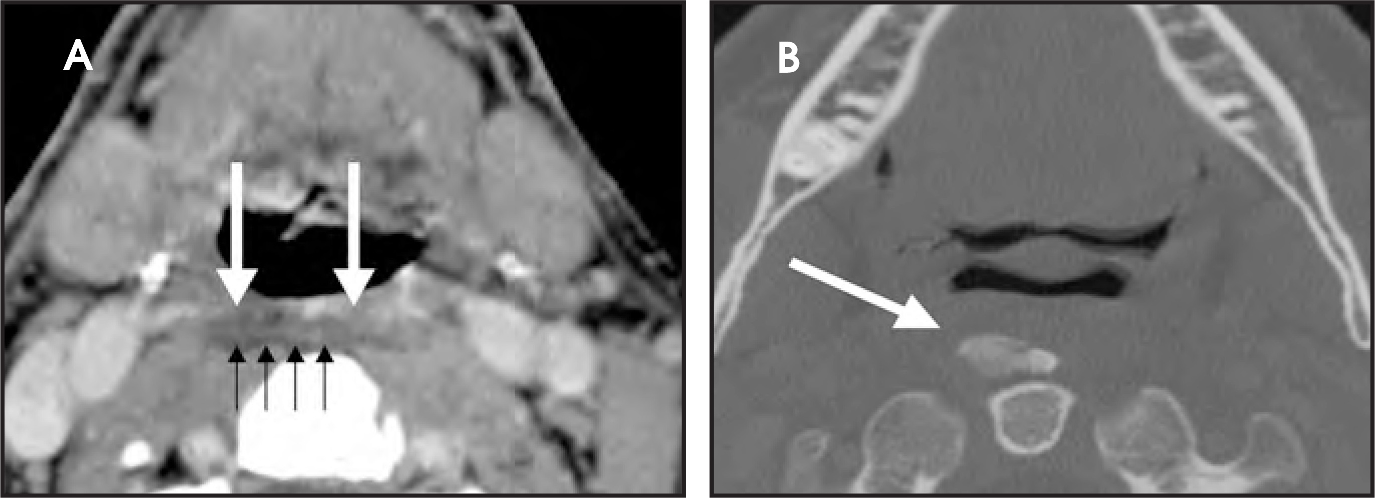 FIGURE 13.