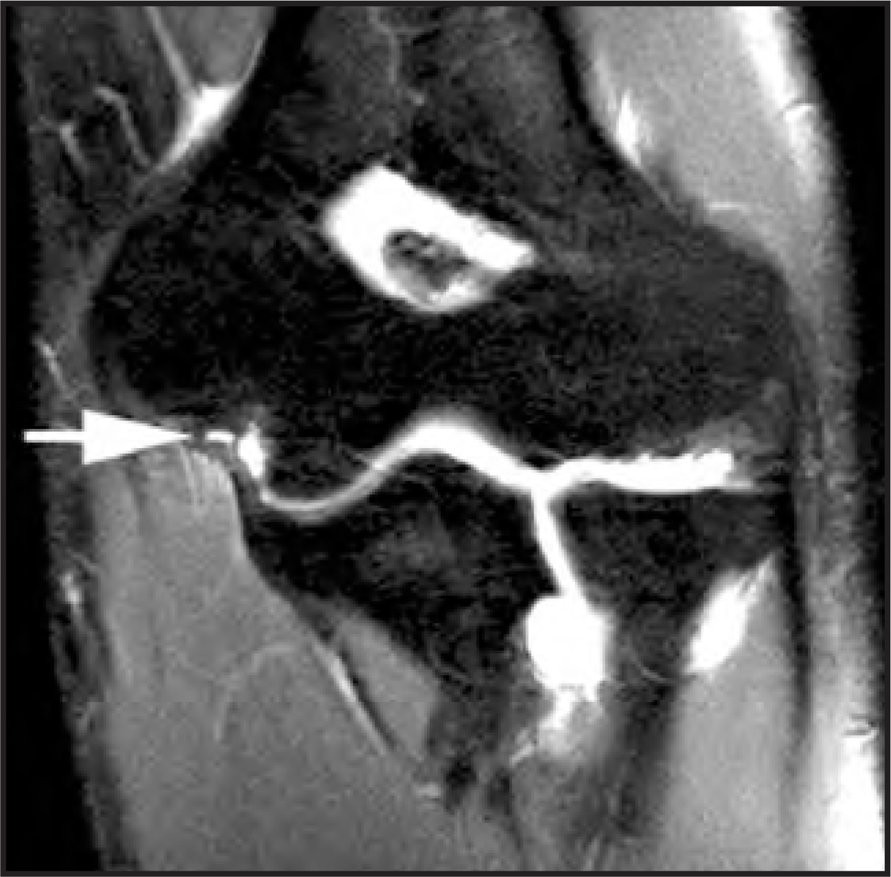 FIGURE 11.