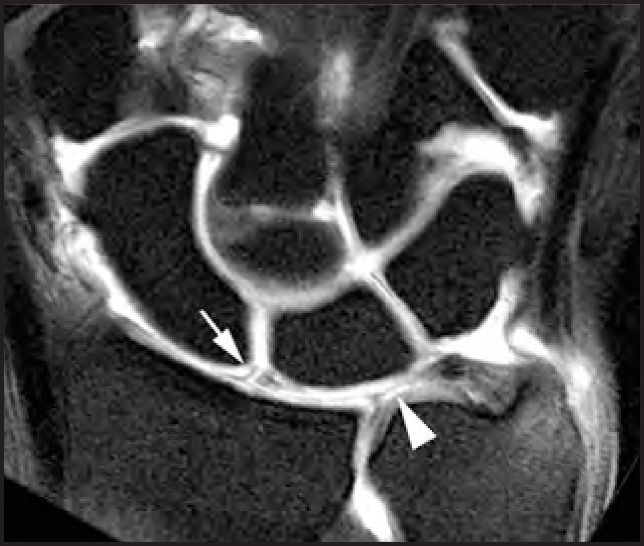 FIGURE 13.