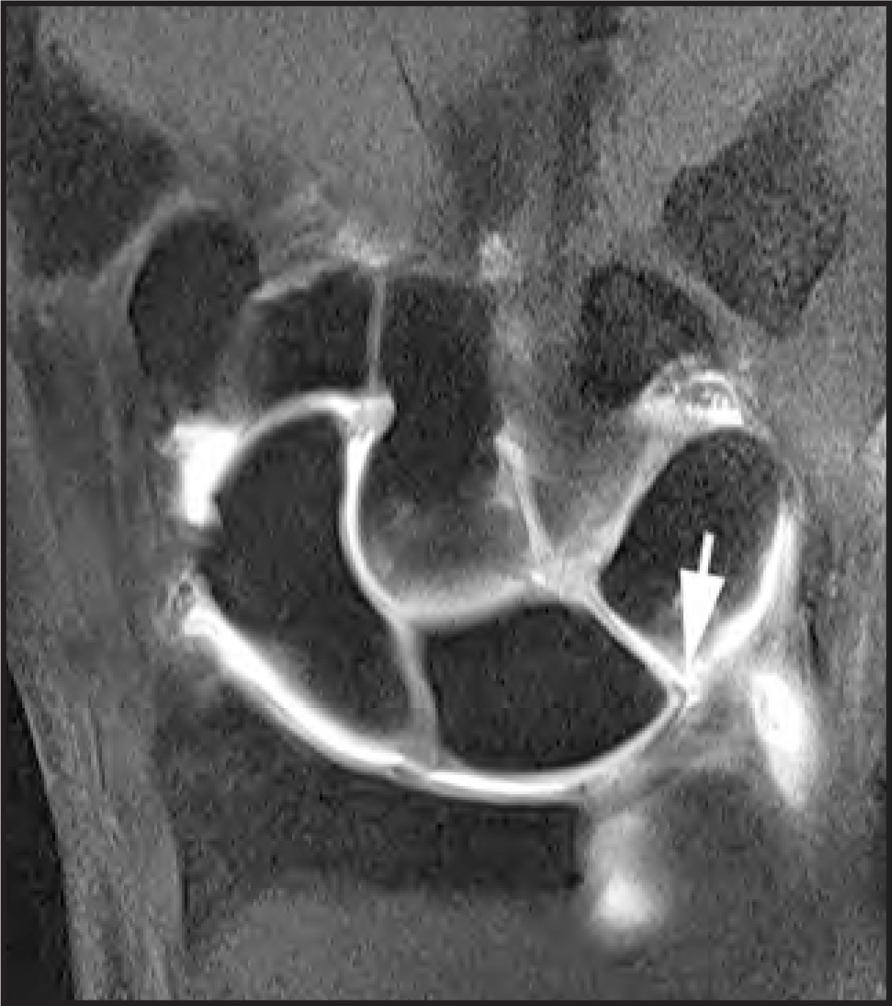 FIGURE 14.
