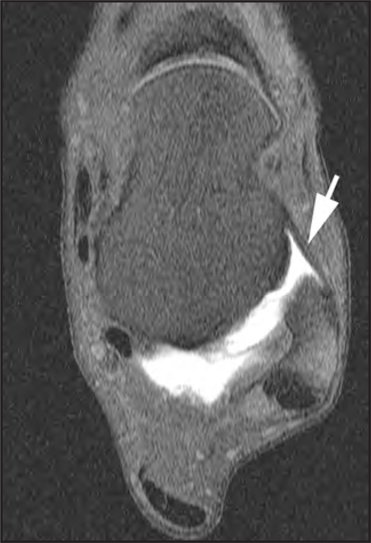 FIGURE 22.