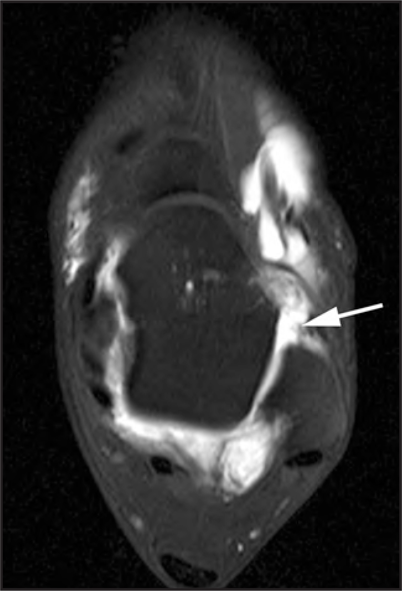 FIGURE 23.