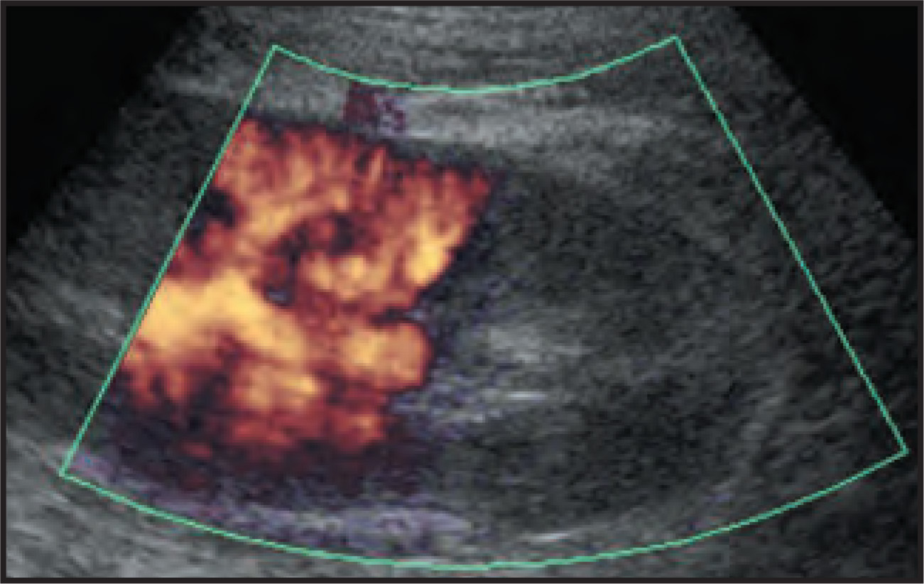 FIGURE 4.