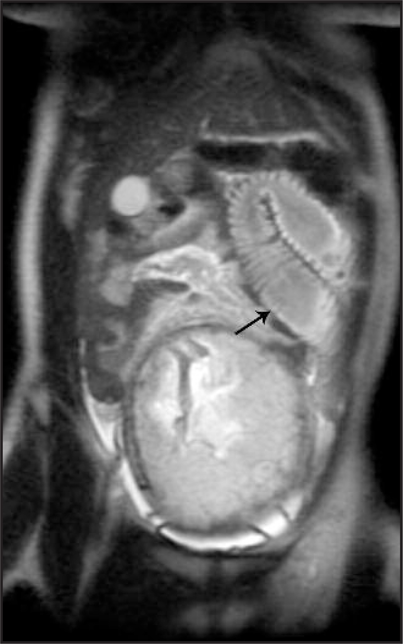 FIGURE 11.