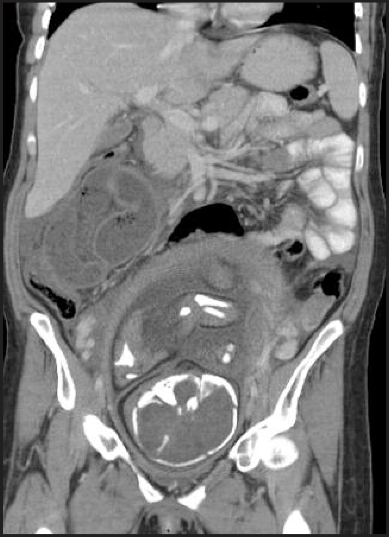FIGURE 12.