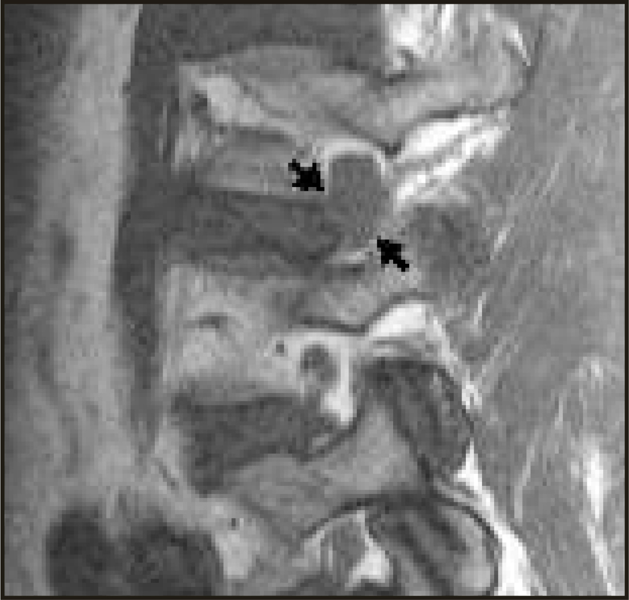 FIGURE 11.