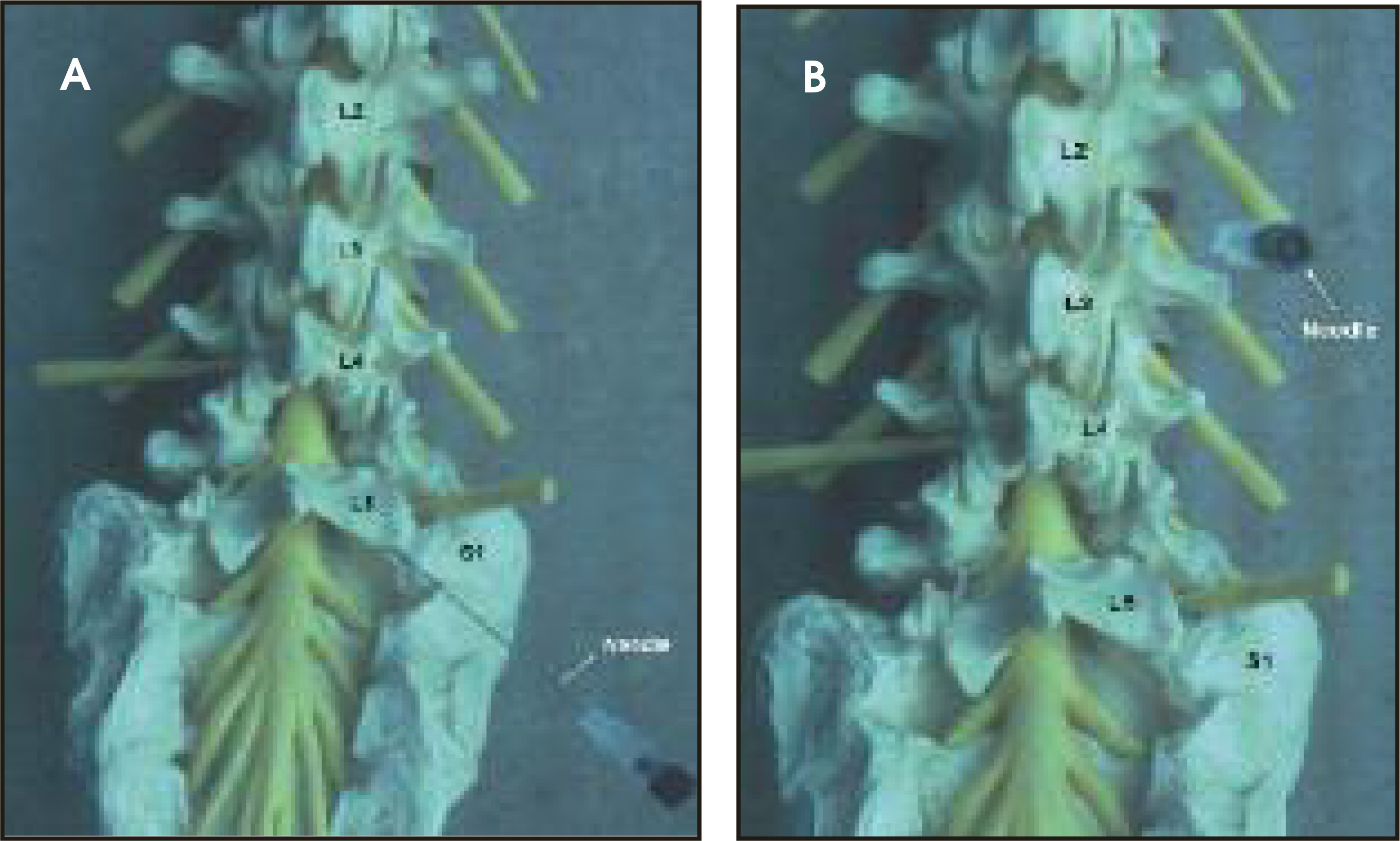 FIGURE 14.