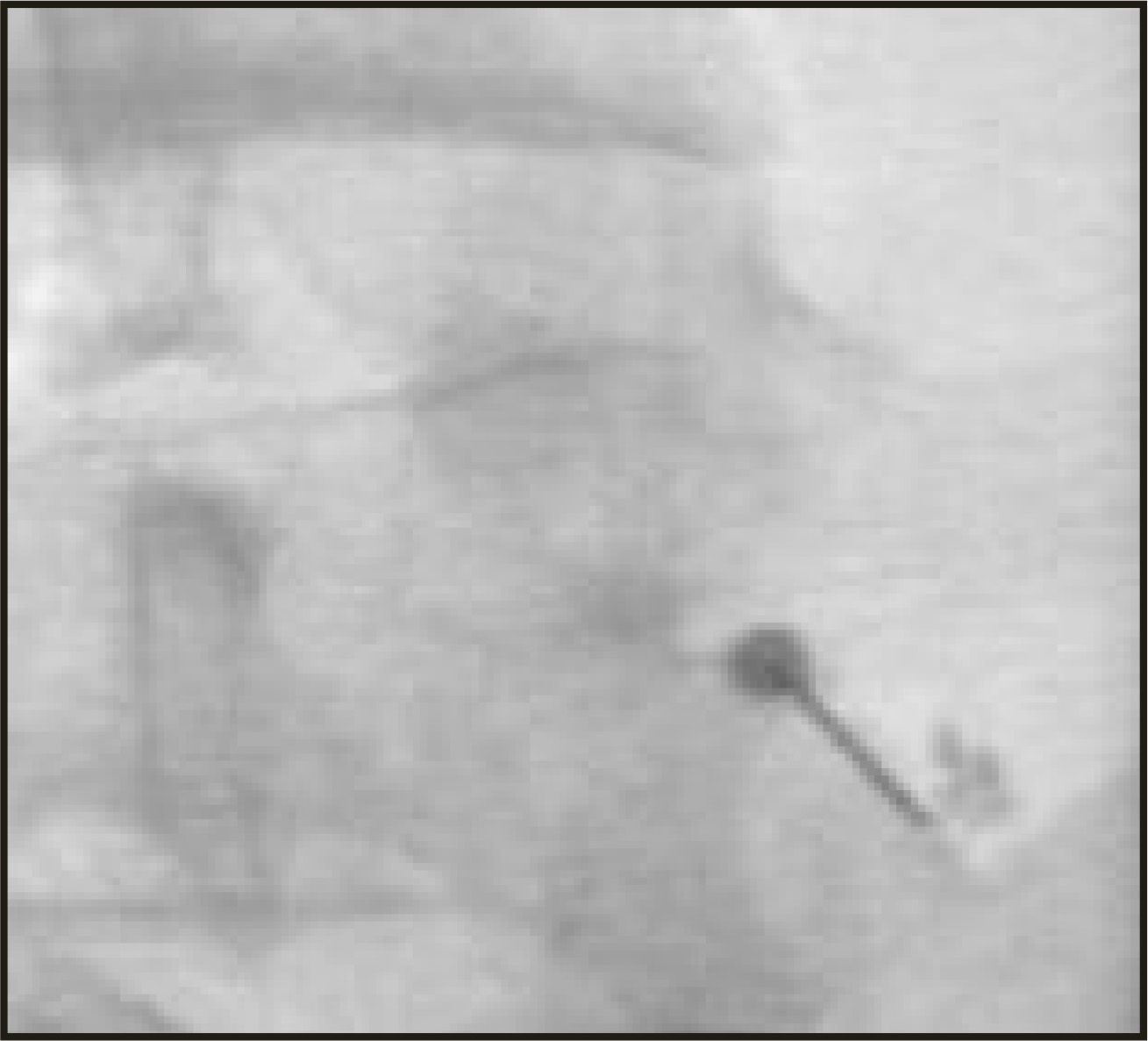 FIGURE 16.