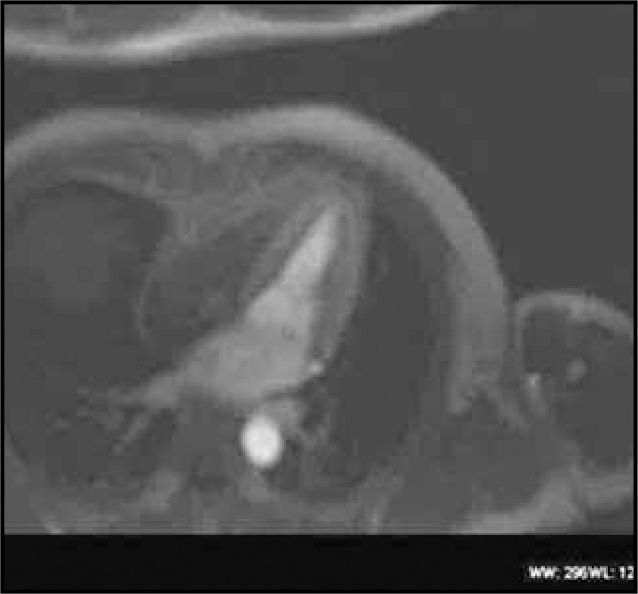 FIGURE 13.