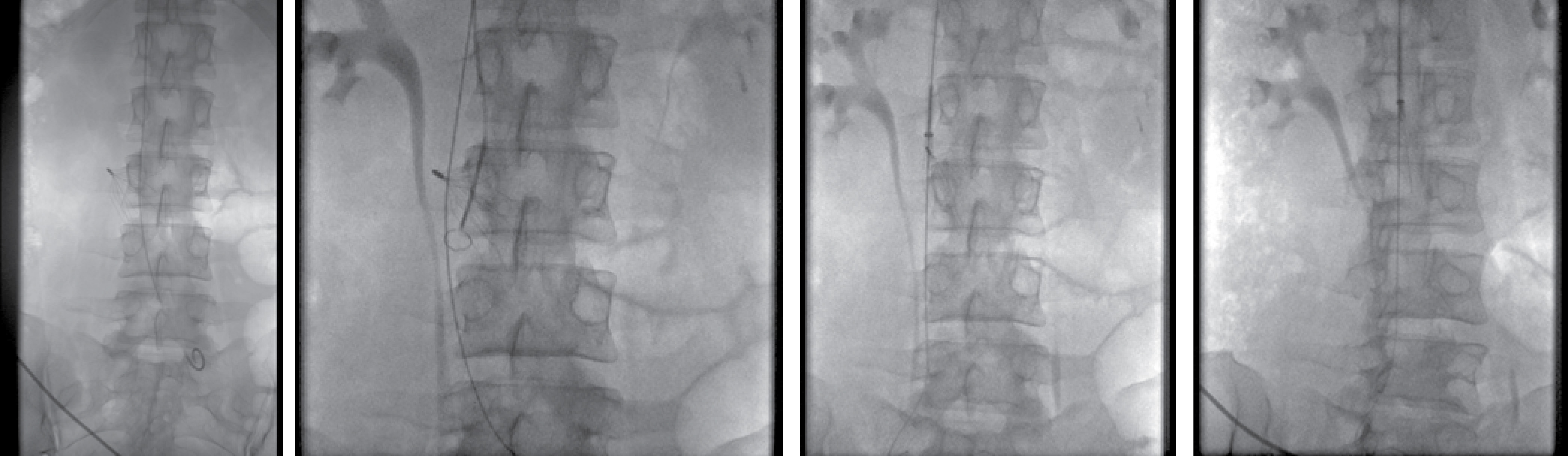 FIGURE 11.