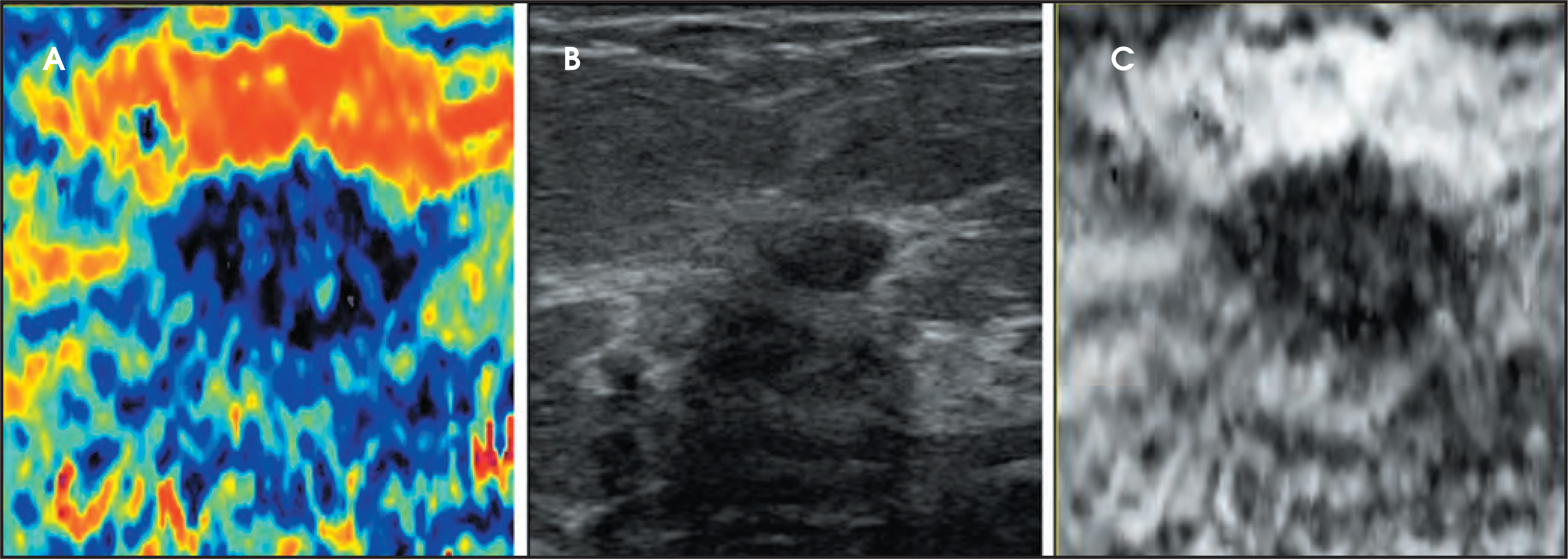 FIGURE 4.