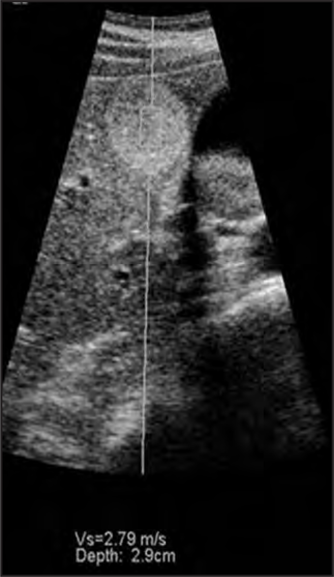 FIGURE 12.