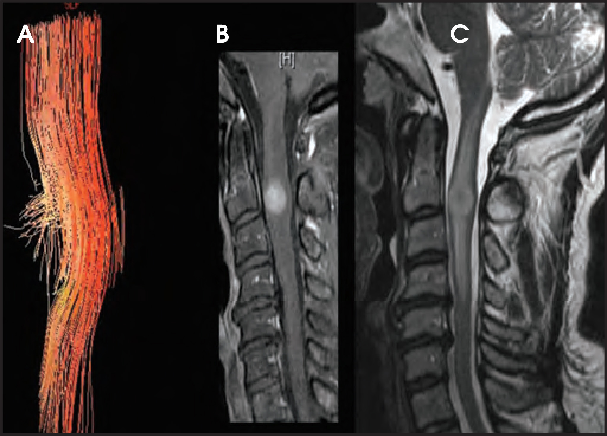 FIGURE 11.