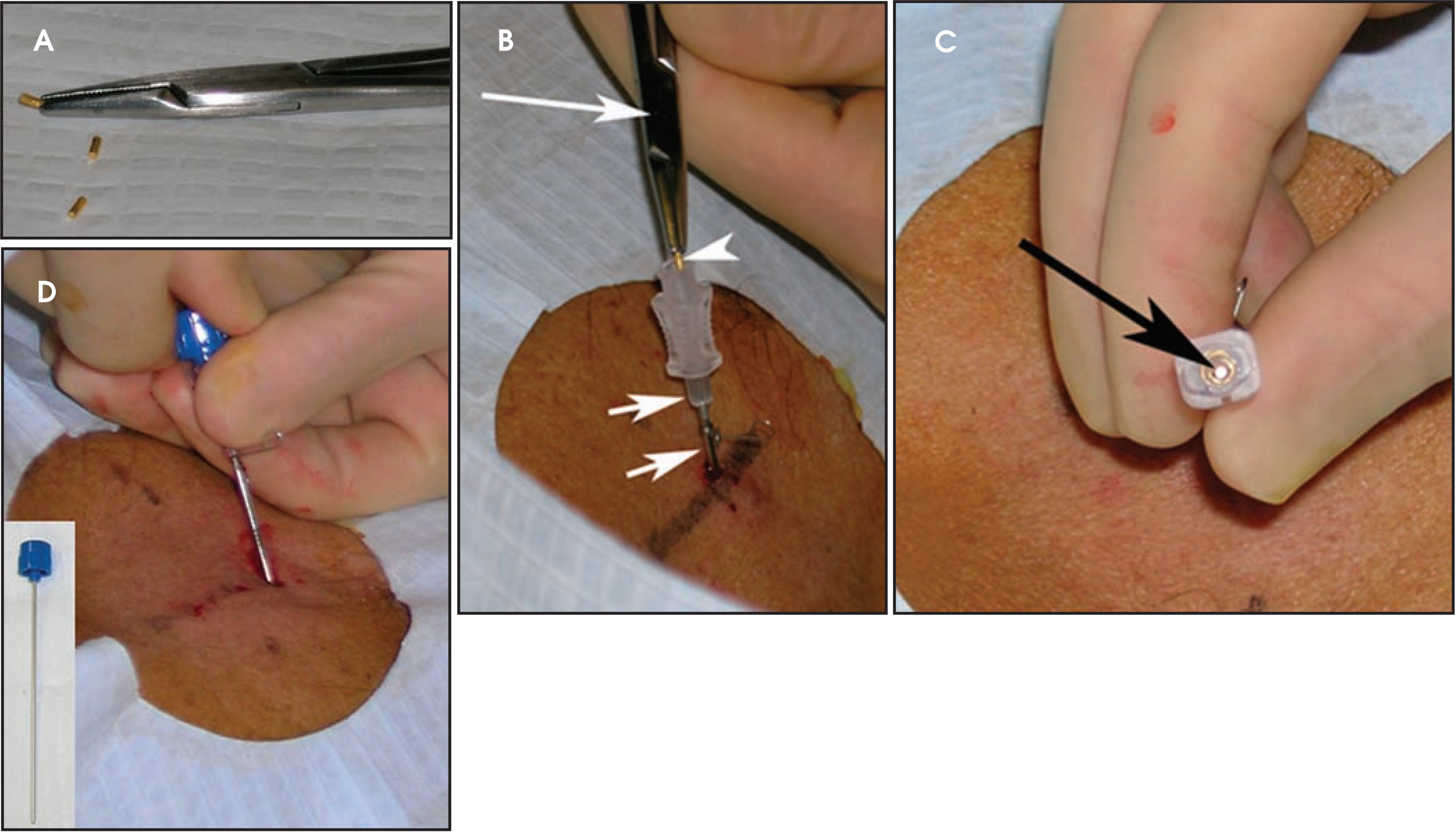 FIGURE 11.