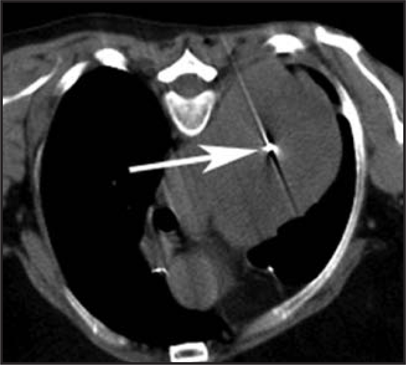 FIGURE 13.