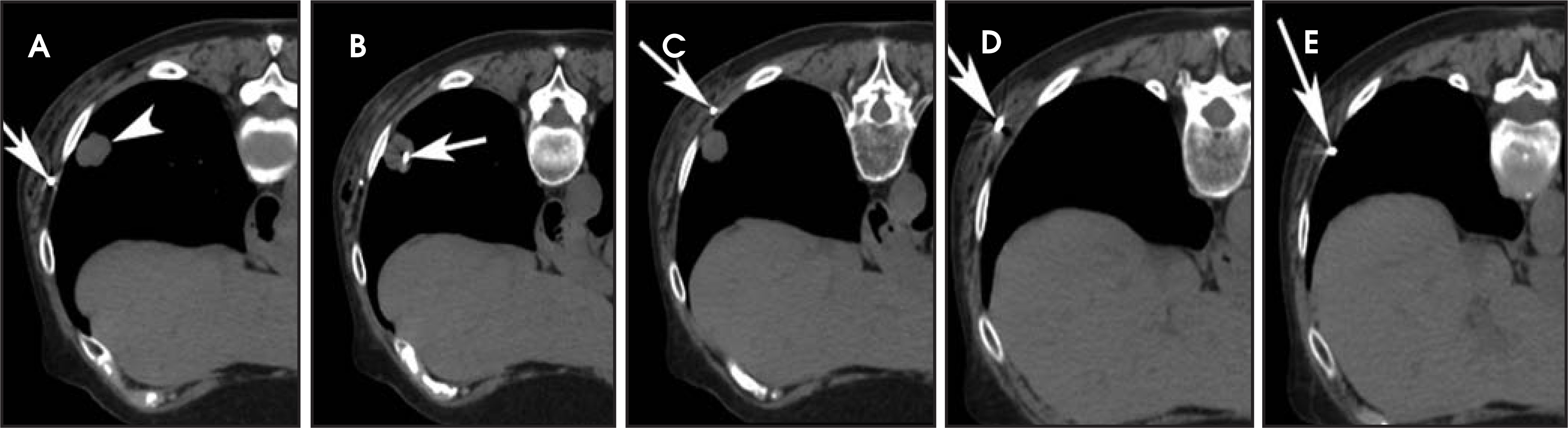 FIGURE 14.
