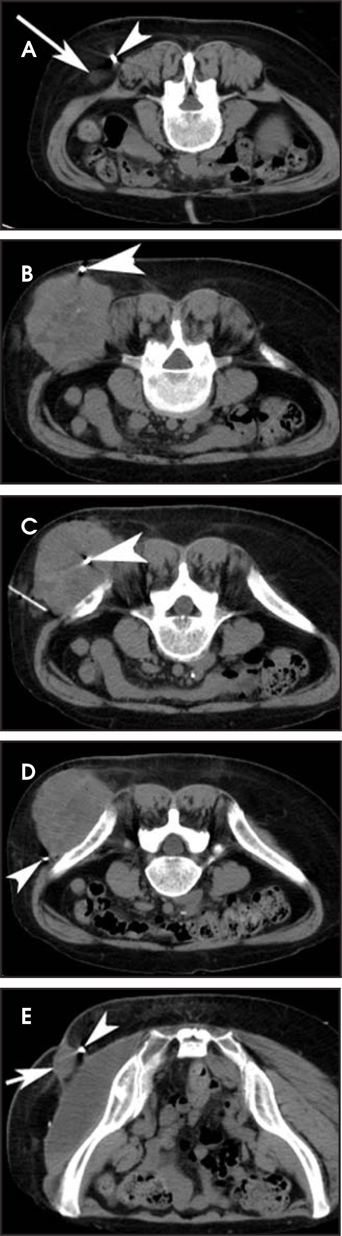 FIGURE 16.