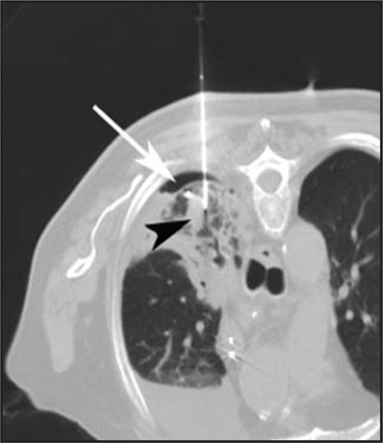 FIGURE 17.