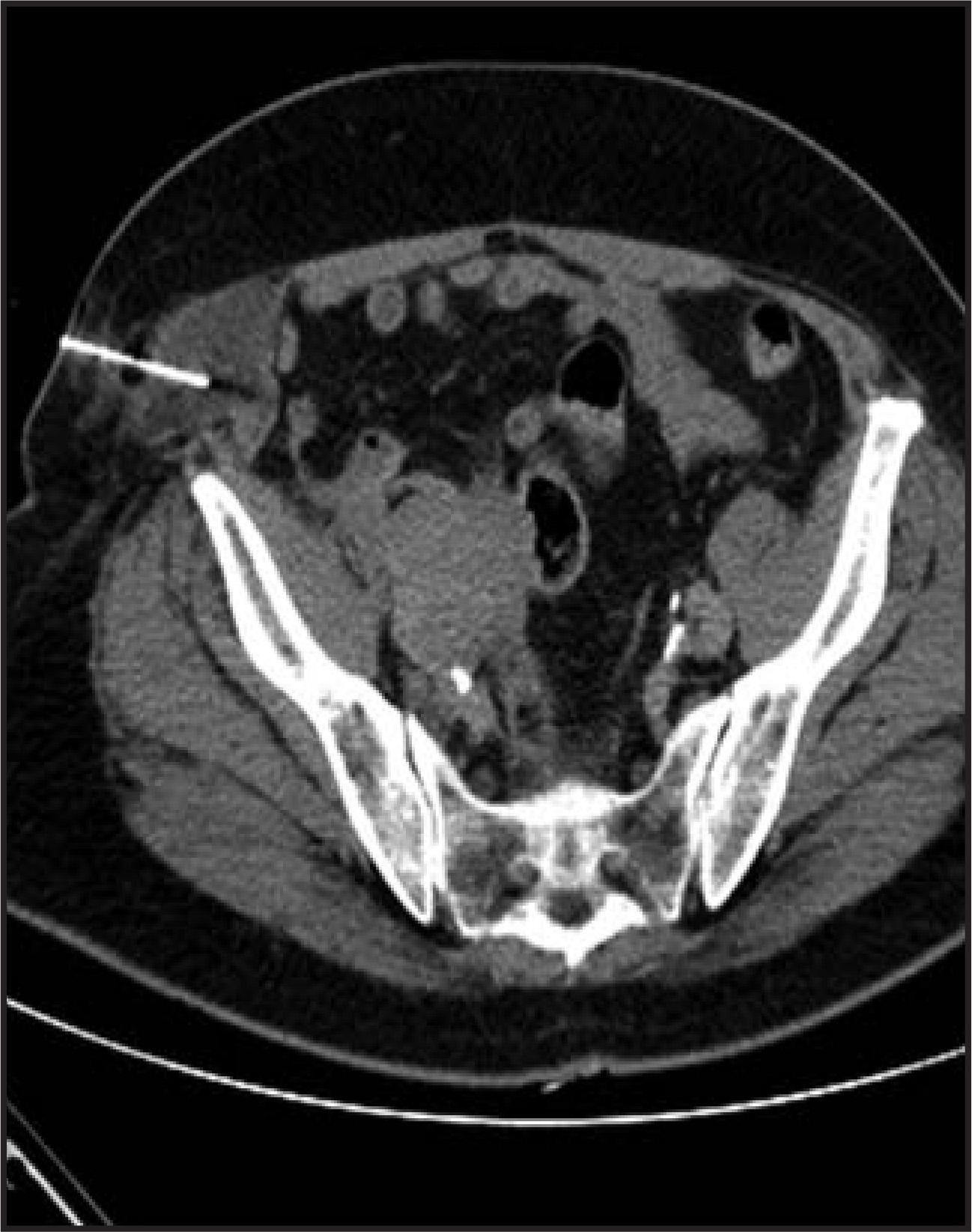 FIGURE 18.