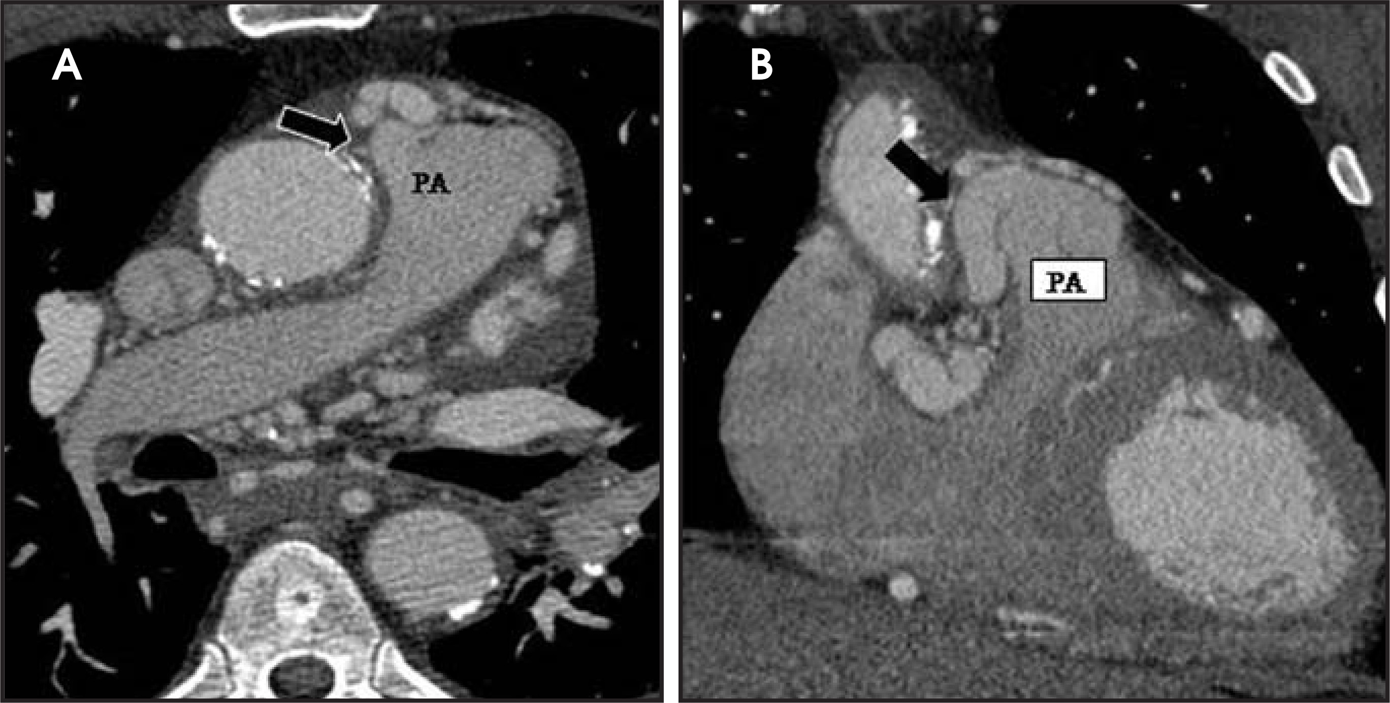 FIGURE 11.