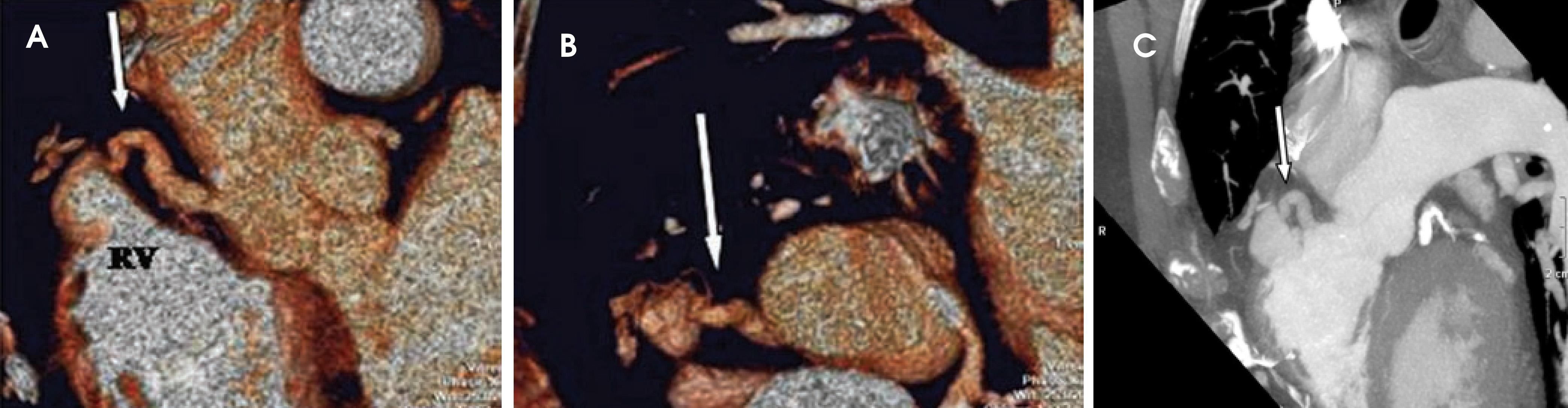 FIGURE 14.
