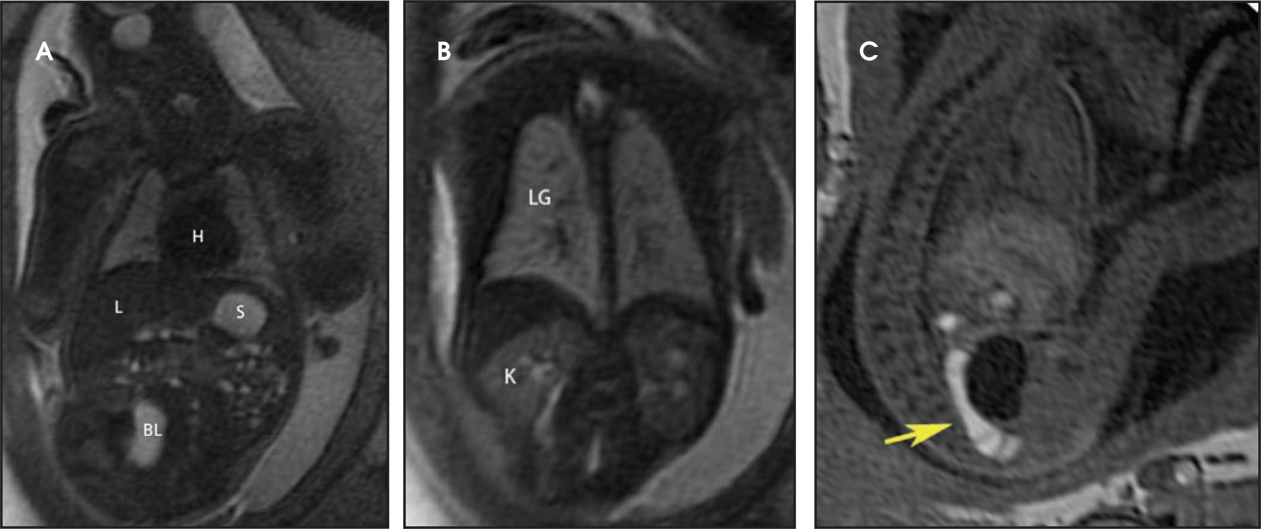 FIGURE 3.