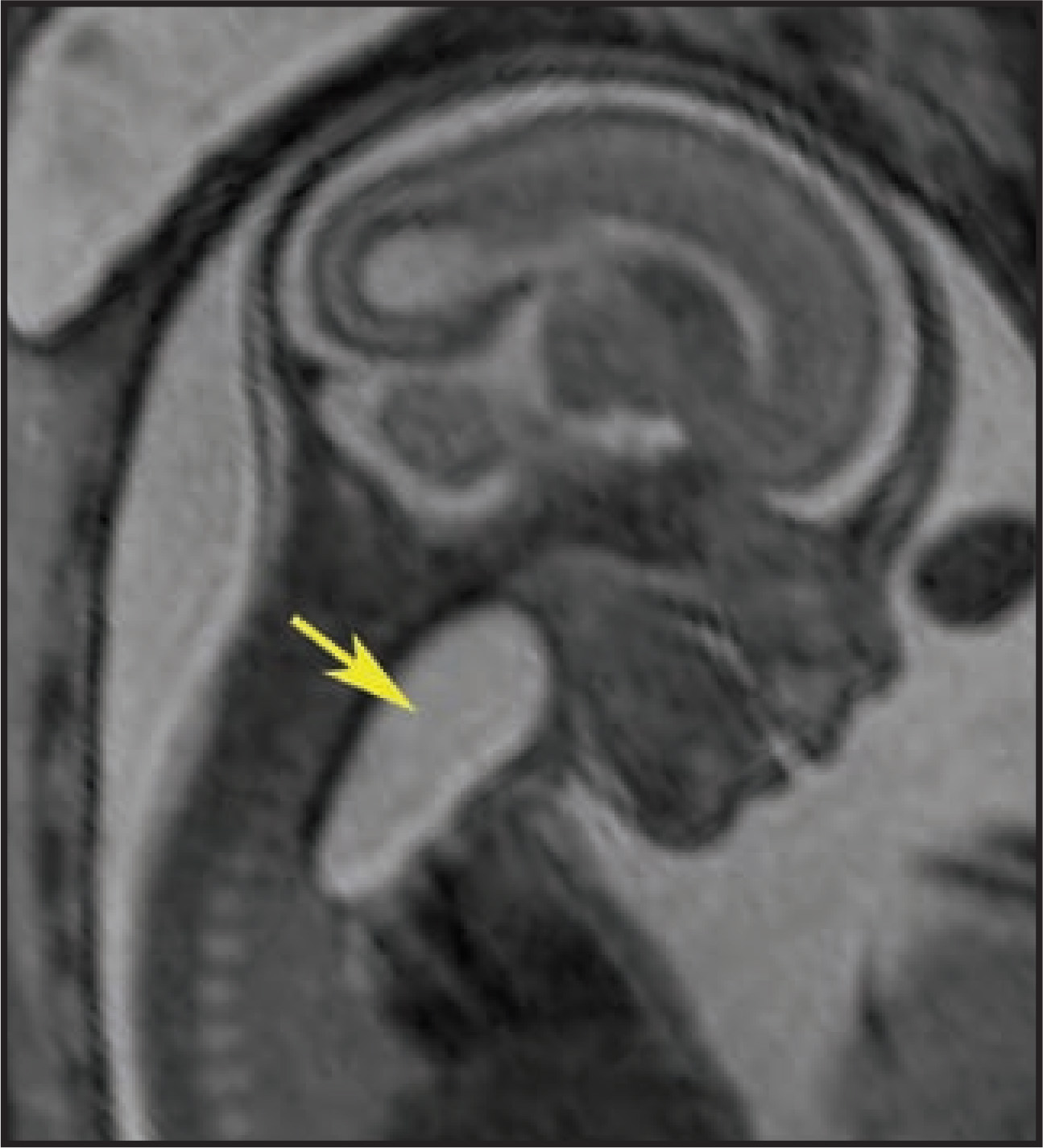 FIGURE 9.