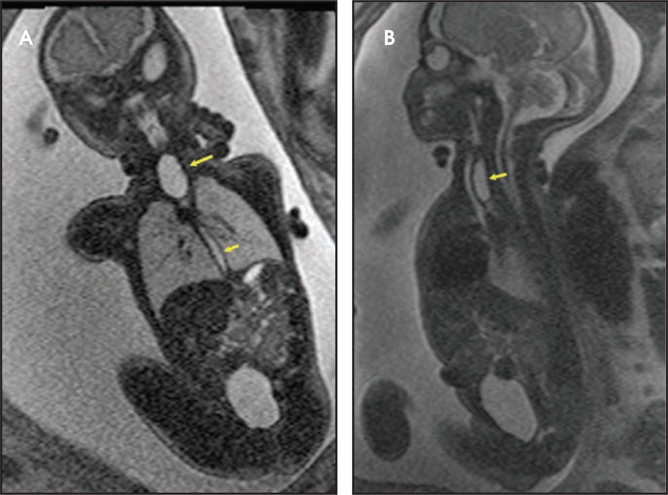 FIGURE 11.