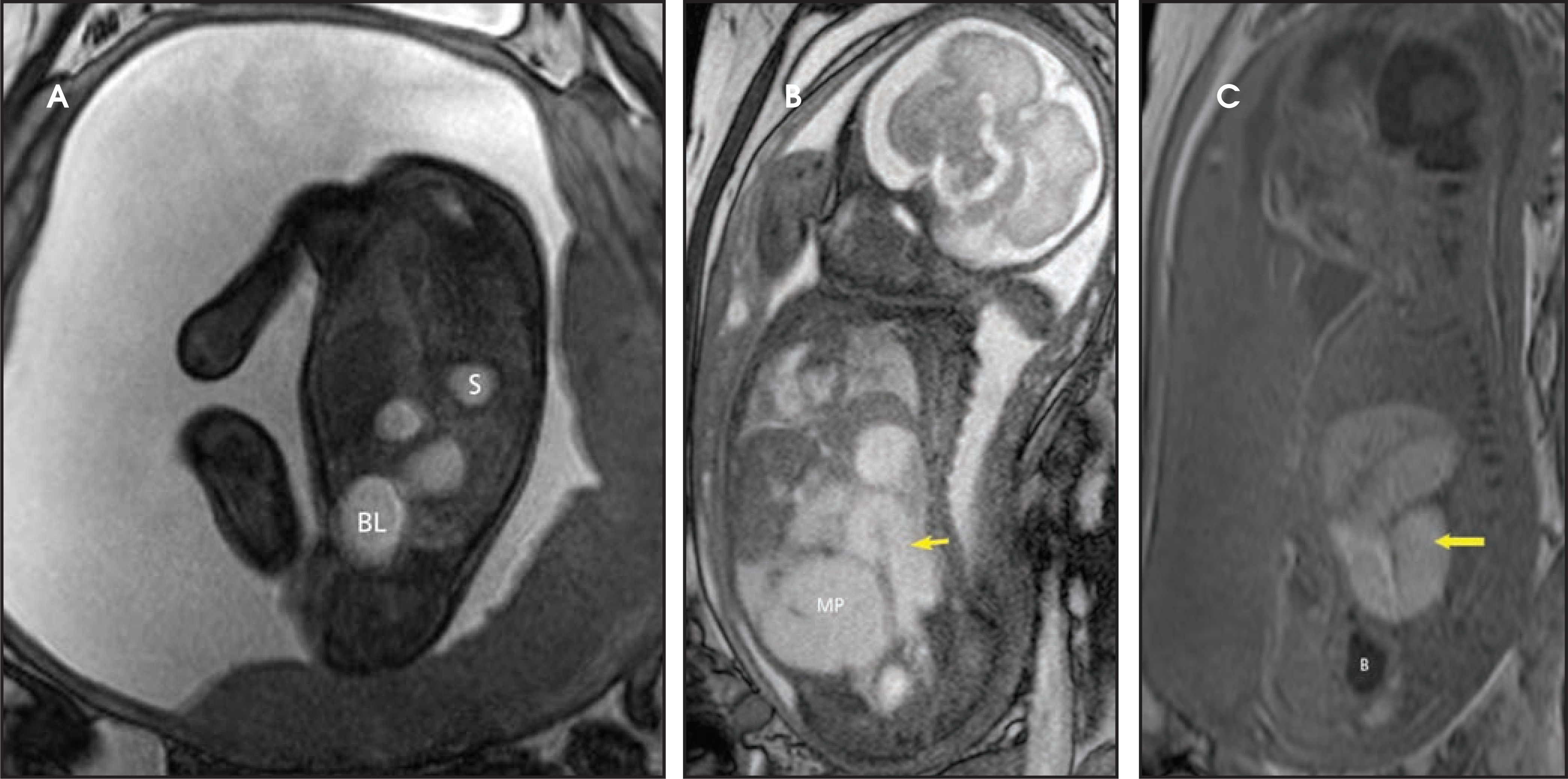FIGURE 13.