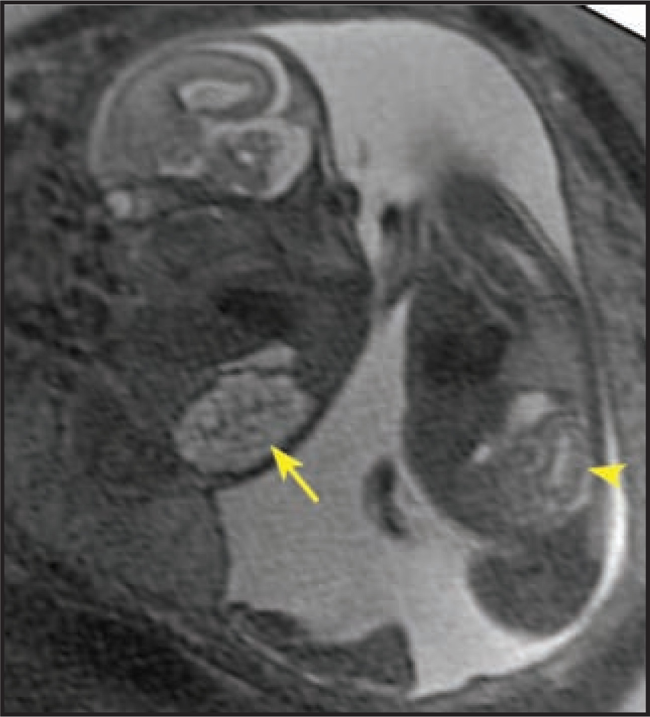 FIGURE 14.