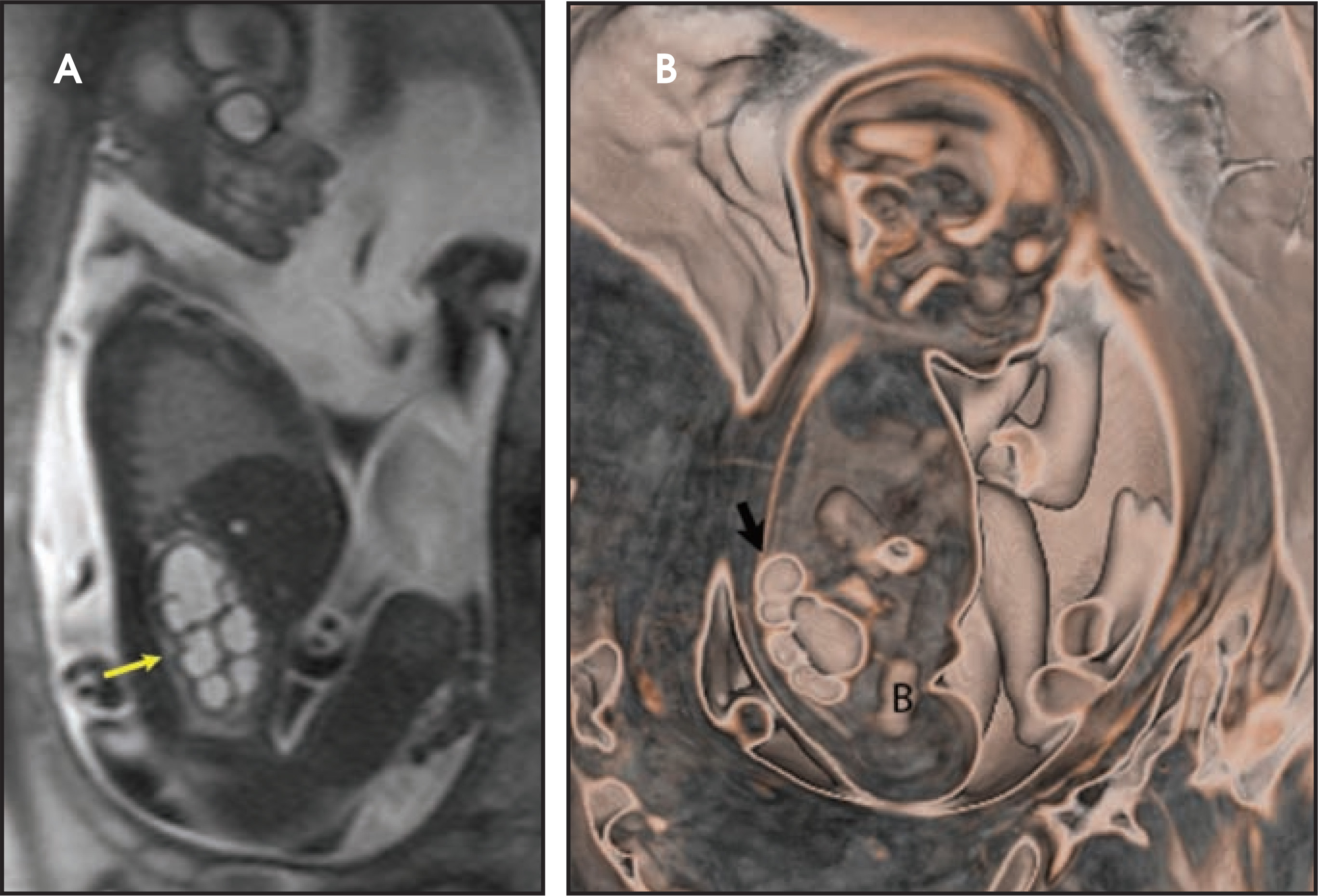 FIGURE 16.