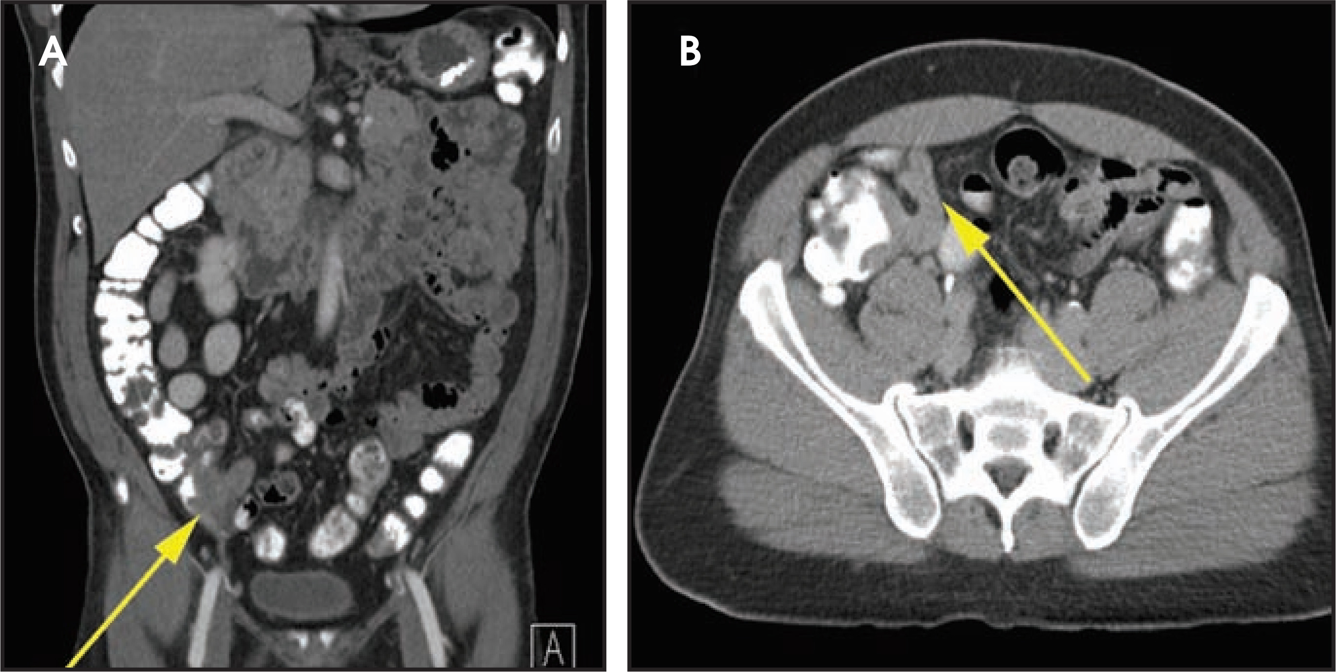 FIGURE 10.
