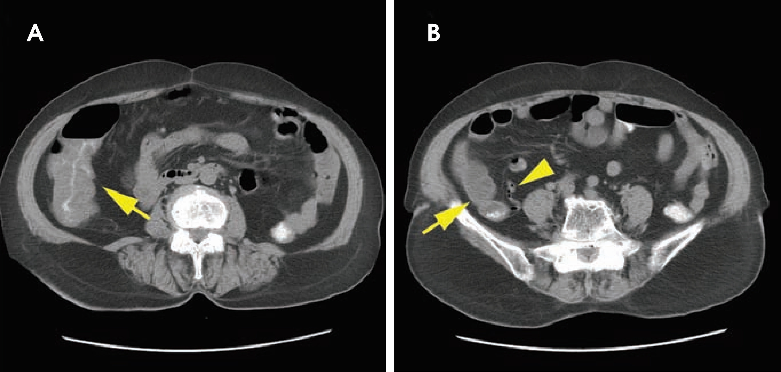 FIGURE 11.