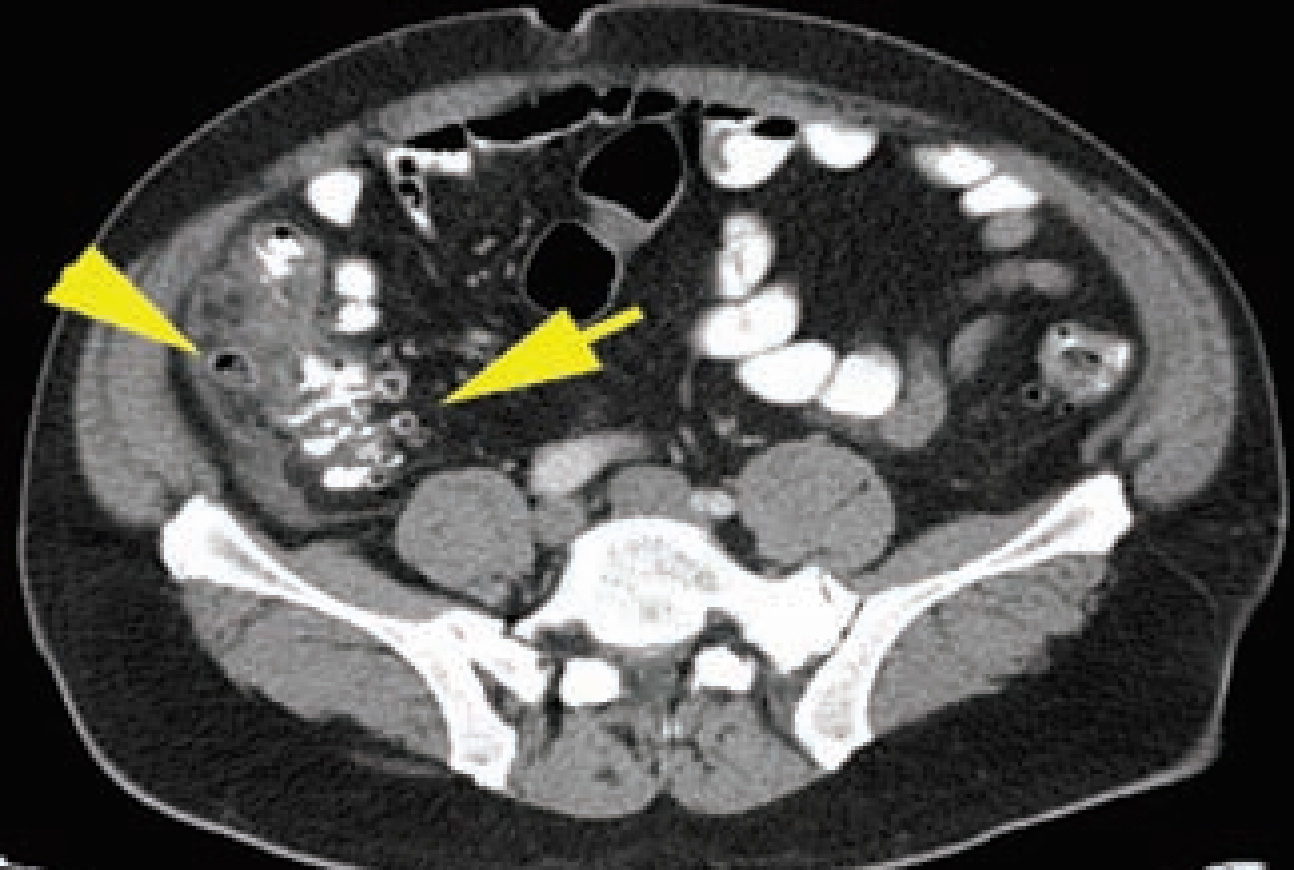 FIGURE 12.