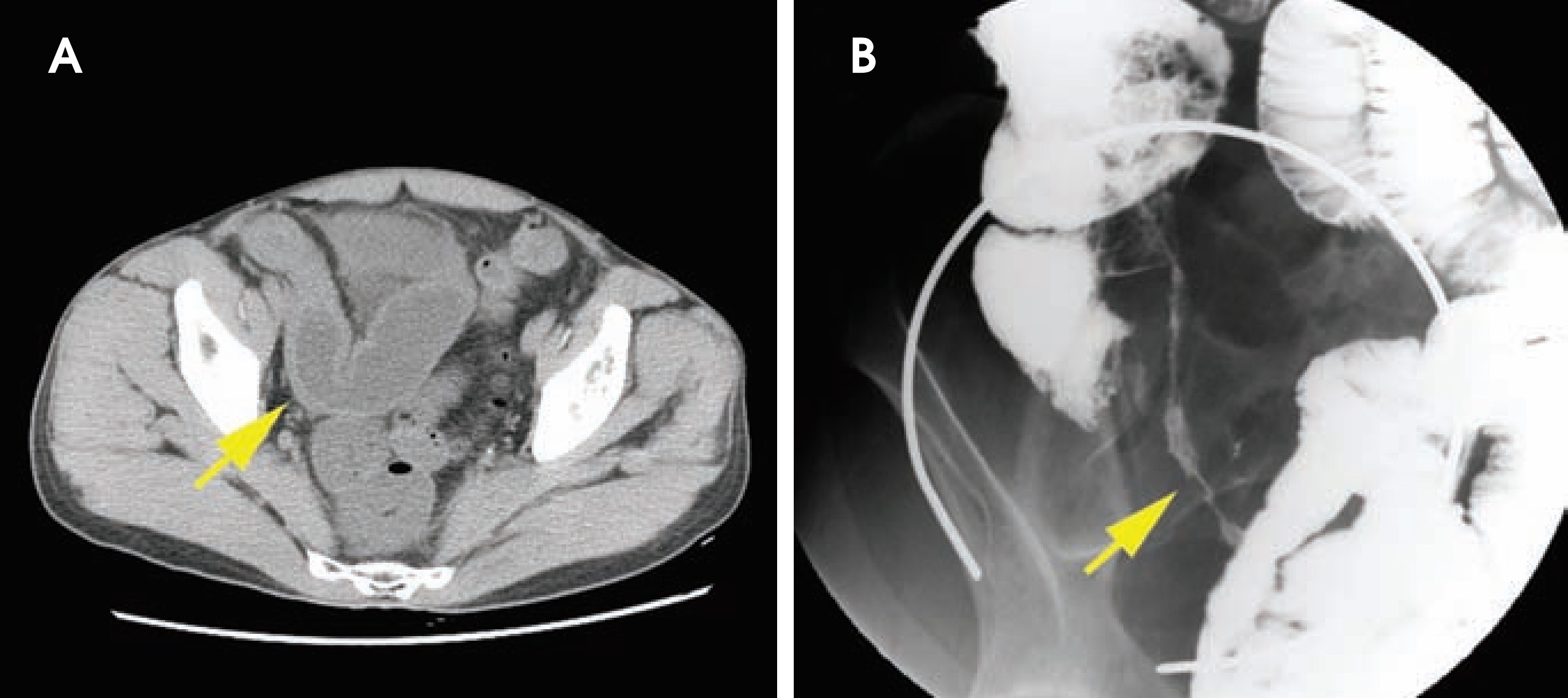 FIGURE 13.