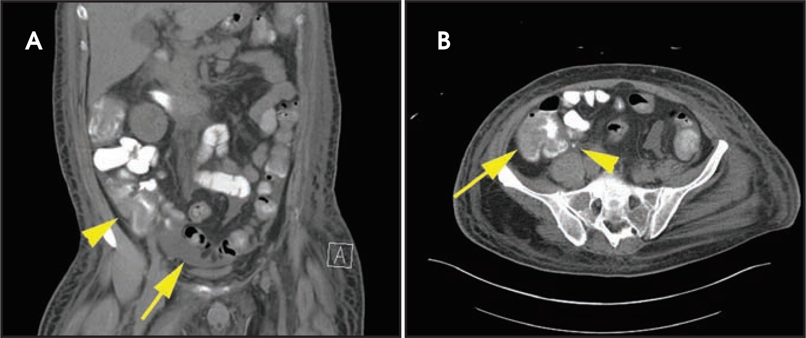 FIGURE 14.