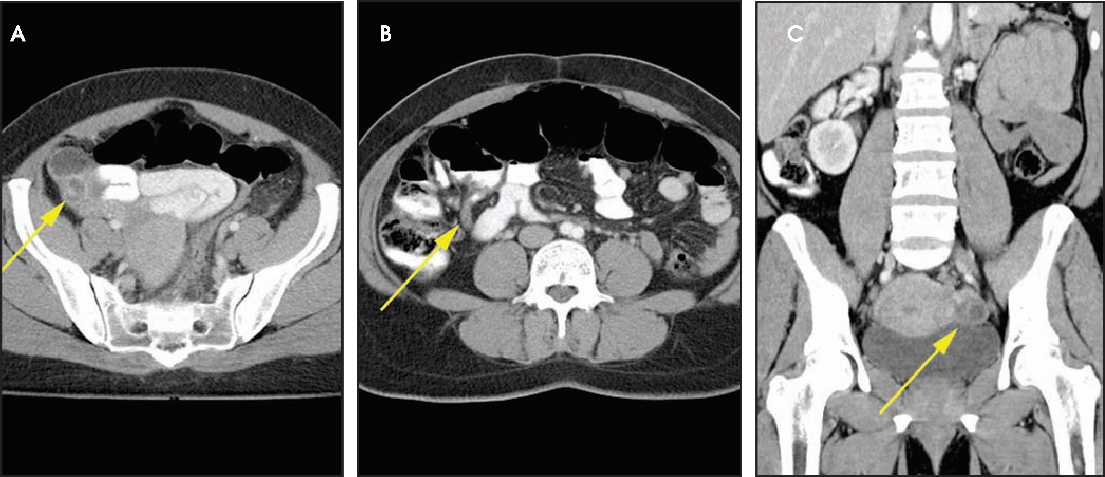FIGURE 16.