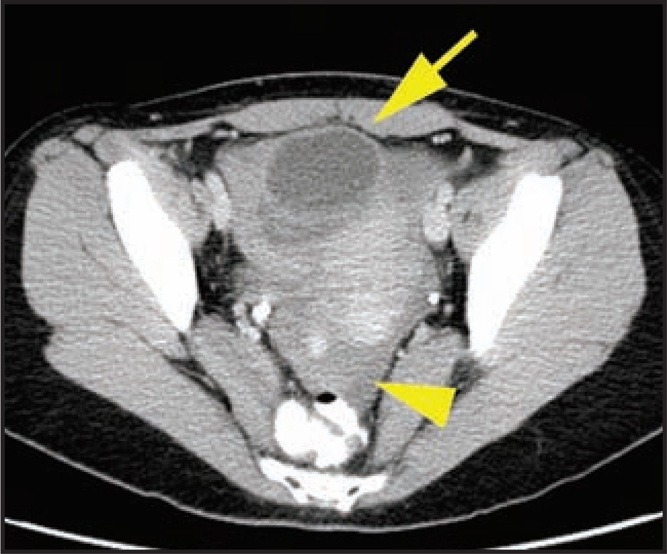 FIGURE 17.