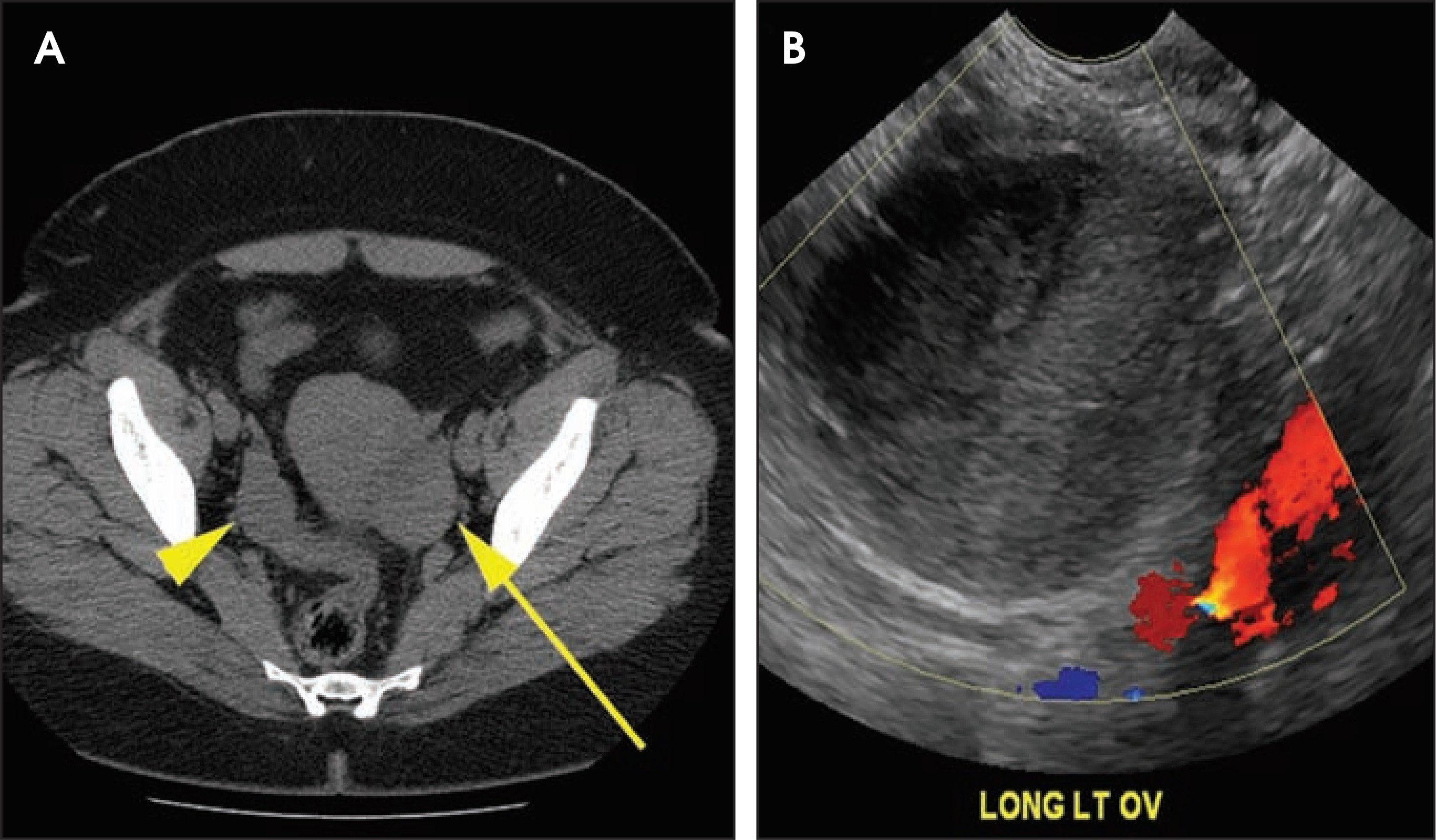 FIGURE 18.