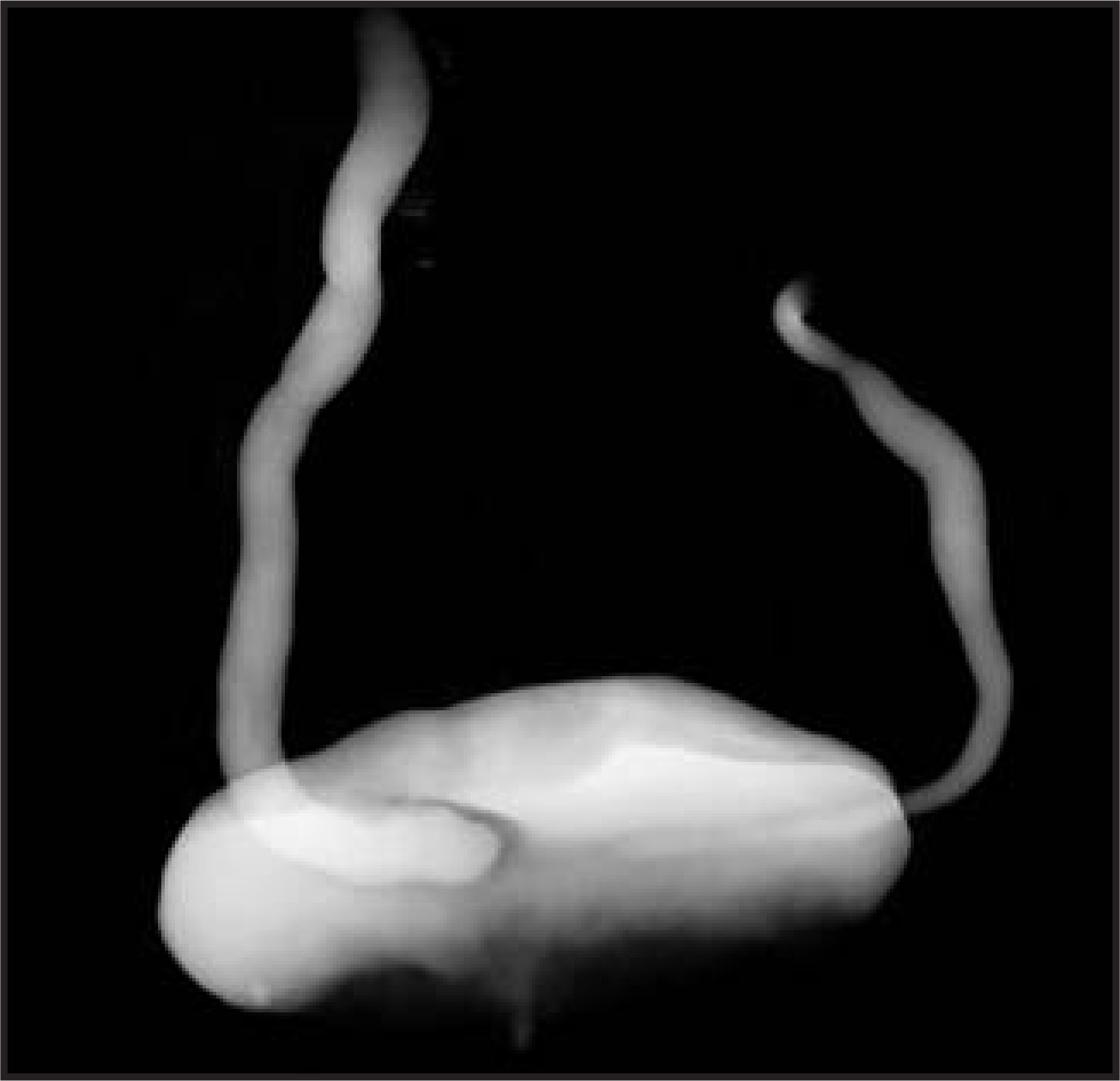 FIGURE 11.